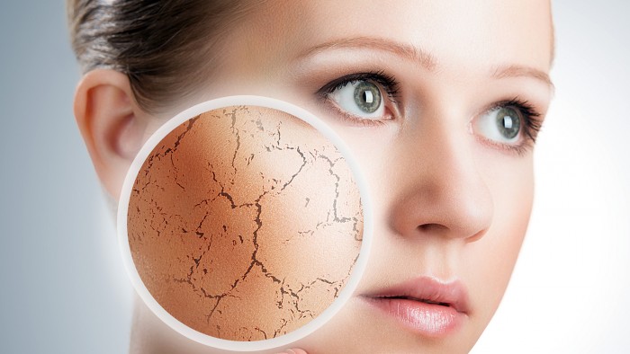 pelle secca rimedi naturali e prodotti