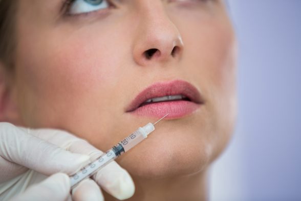 iniezioni filler rughe naso labiali