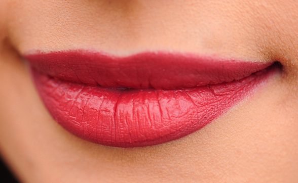prima e dopo filler ialuronico labbra