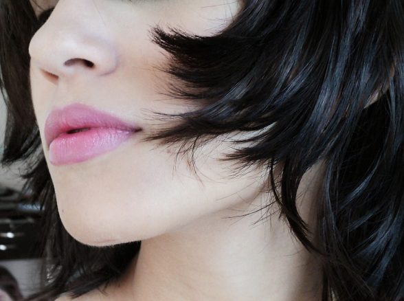 prima e dopo filler mento