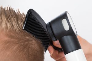 Psoriasi del cuoio capelluto