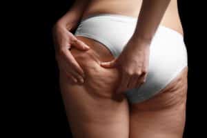 Cerotti drenanti cellulite