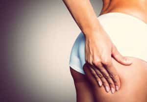 Rimedi naturali contro la cellulite