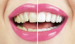 Biowhite