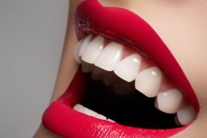 Strisce sbiancanti denti