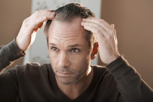 Caduta capelli: rimedi efficaci contro la perdita