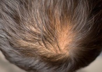 farmaci contro la caduta dei capelli