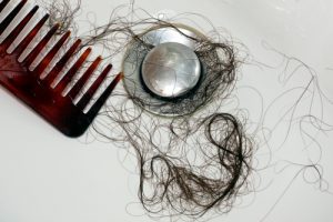 Perdita capelli stress
